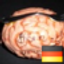 hirngabel